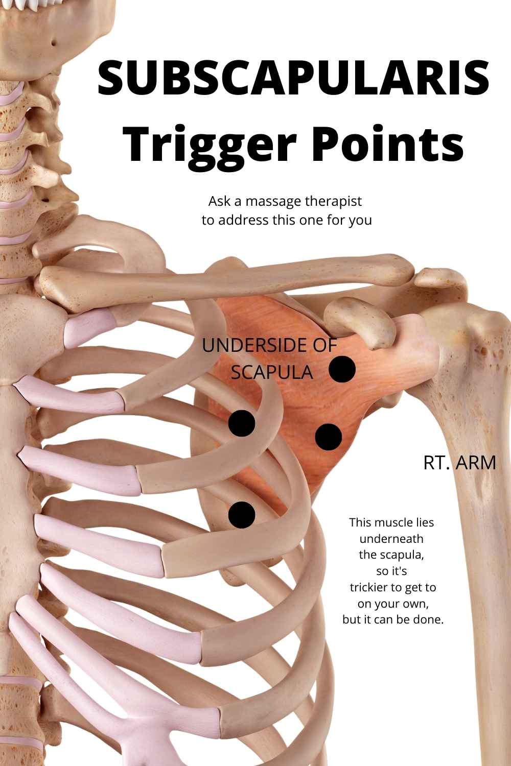 frozen shoulder trigger points